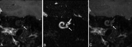 FIG 2.
