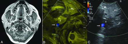 FIG 2.