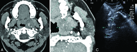 FIG 4.