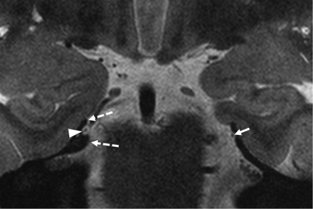 FIG 5.