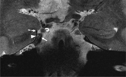 FIG 6.