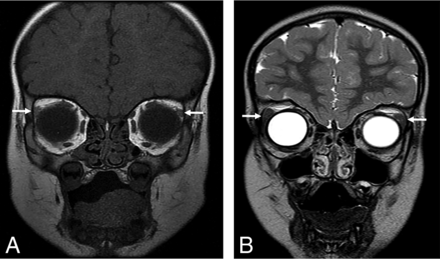 FIG 2.