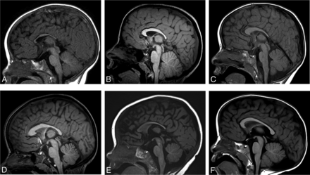 FIG 3.