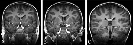 FIG 4.
