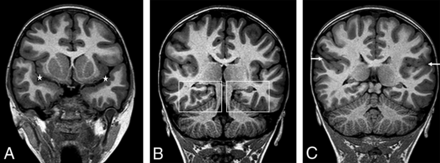 FIG 5.