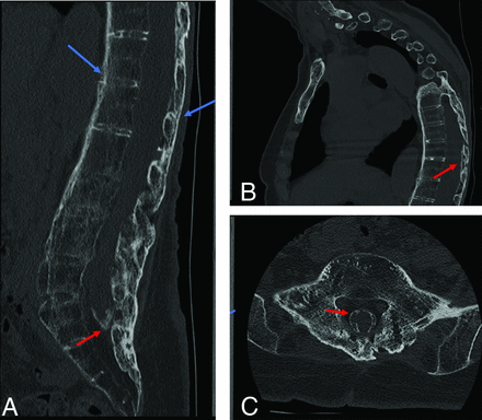 FIG 2.