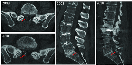 FIG 4.