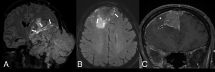 FIG 3.