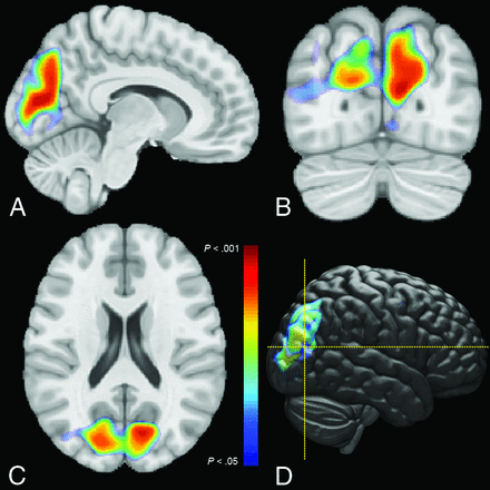 FIG 2.