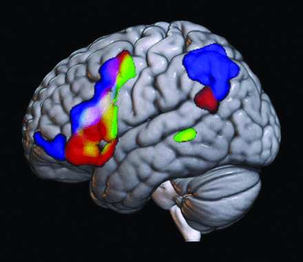 FIG 3.