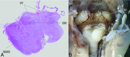 FIG 3.