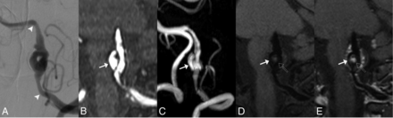 FIG 2.