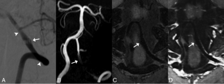 FIG 3.
