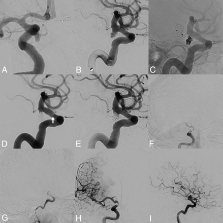 FIG 2.