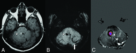 FIG 3.