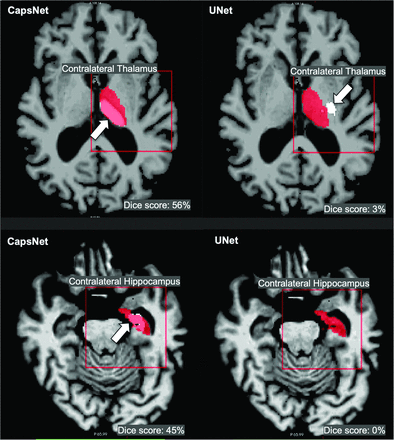 FIG 3.