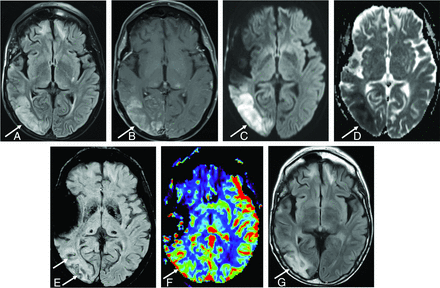 FIG 3.