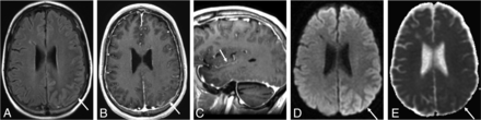 FIG 5.