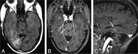 FIG 6.