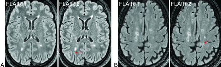 FIG 3.