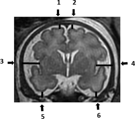 FIG 2.