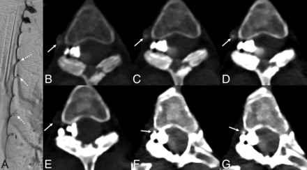 Fig 2.