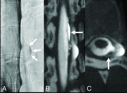 FIG 2.