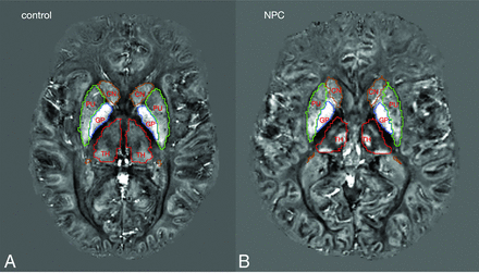 FIG 3.