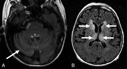FIG 3.