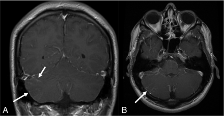 FIG 6.
