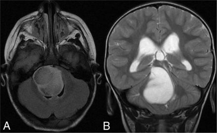 FIG 4.