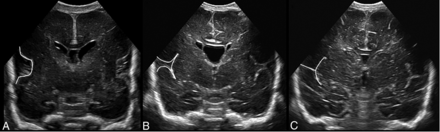 FIG 3.