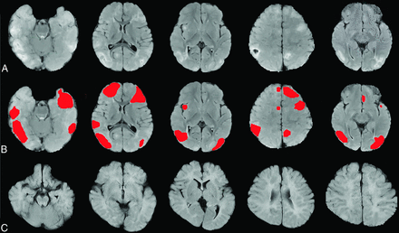 FIG 2.