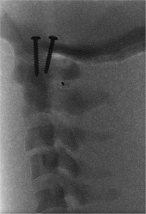 FIG 3.