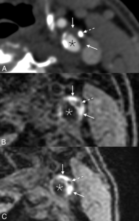 FIG 2.
