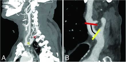 FIG 2.