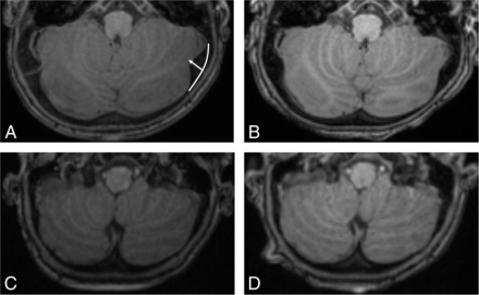 FIG 1.