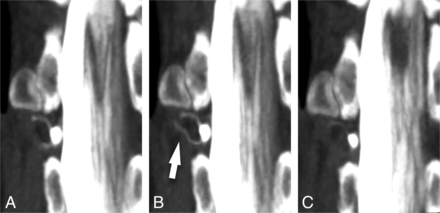 FIG 1.