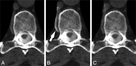 FIG 2.