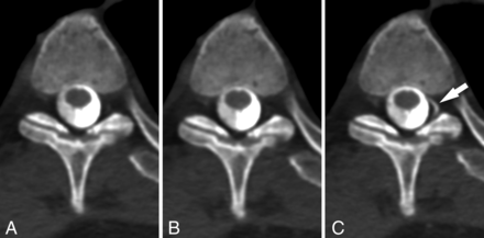 FIG 3.