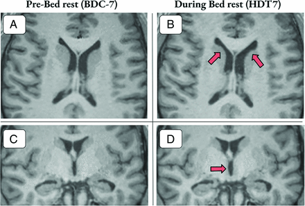 FIG 2.