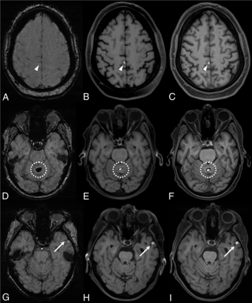 FIG 1.