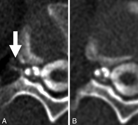 FIG 1.