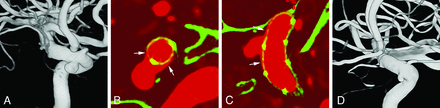FIG 1.