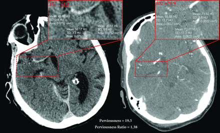FIG 1.