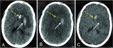 FIG 1.