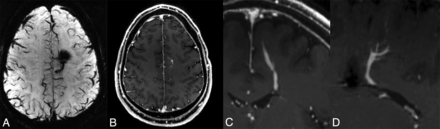 FIG 3.