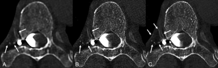 FIG 1.