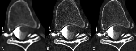 FIG 3.
