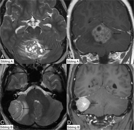 FIG 2.